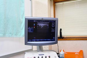 超音波検査機器